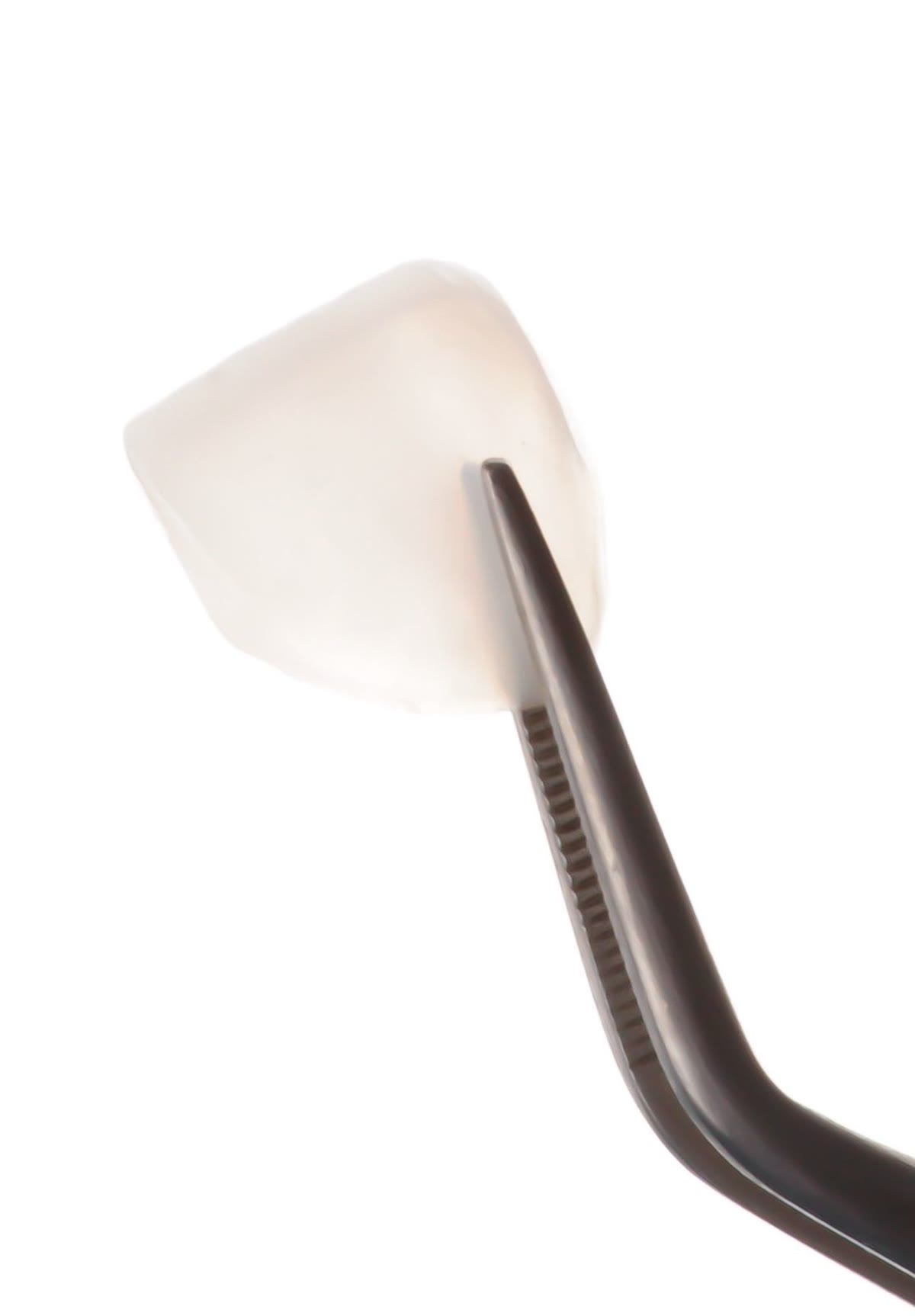 Carilla de porcelana ultra estética — detalle