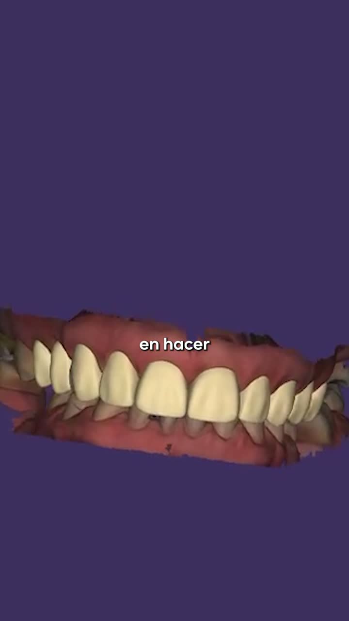 Diseño digital de sonrisa en pantalla